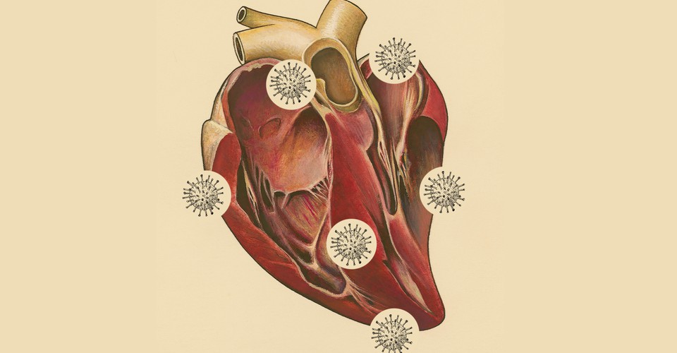 The Core Lesson of the COVID-19 Heart Debate